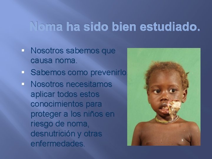 Noma ha sido bien estudiado. § Nosotros sabemos que causa noma. § Sabemos como