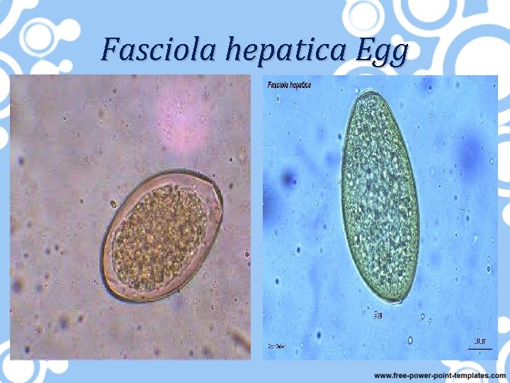 Fasciola hepatica Egg 