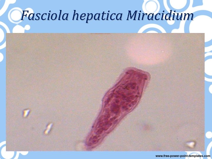 Fasciola hepatica Miracidium 