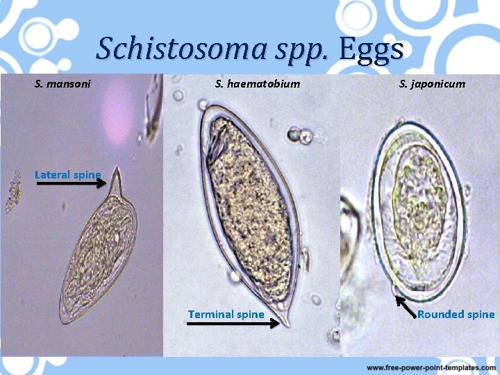Schistosoma spp. Eggs S. mansoni S. haematobium S. japonicum Lateral spine Terminal spine Rounded