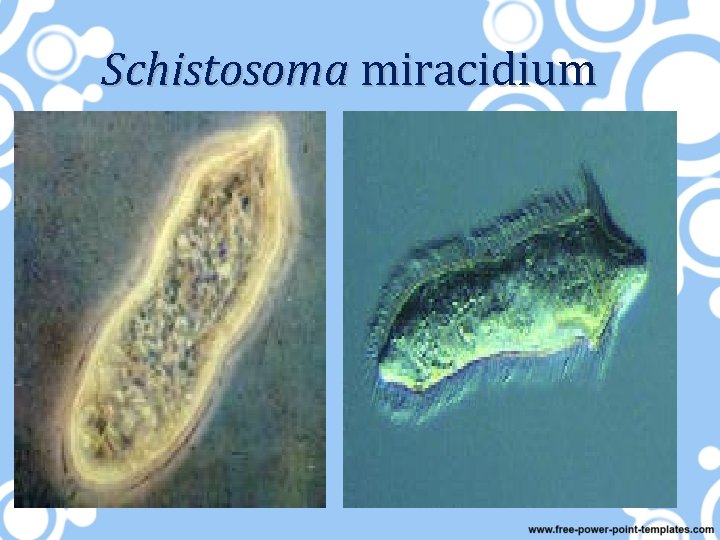 Schistosoma miracidium 