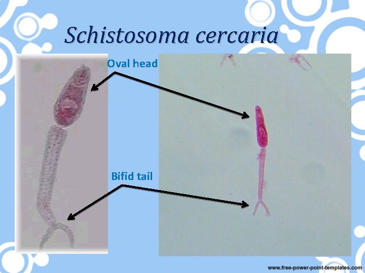 Schistosoma cercaria Oval head Bifid tail 
