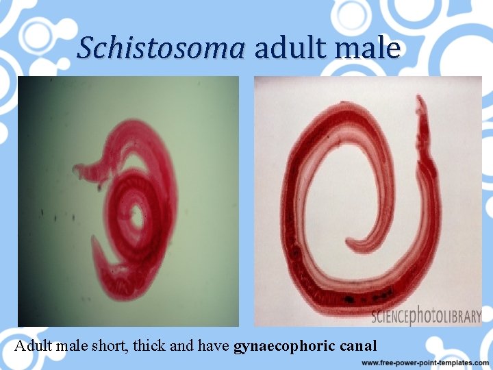 Schistosoma adult male Adult male short, thick and have gynaecophoric canal 