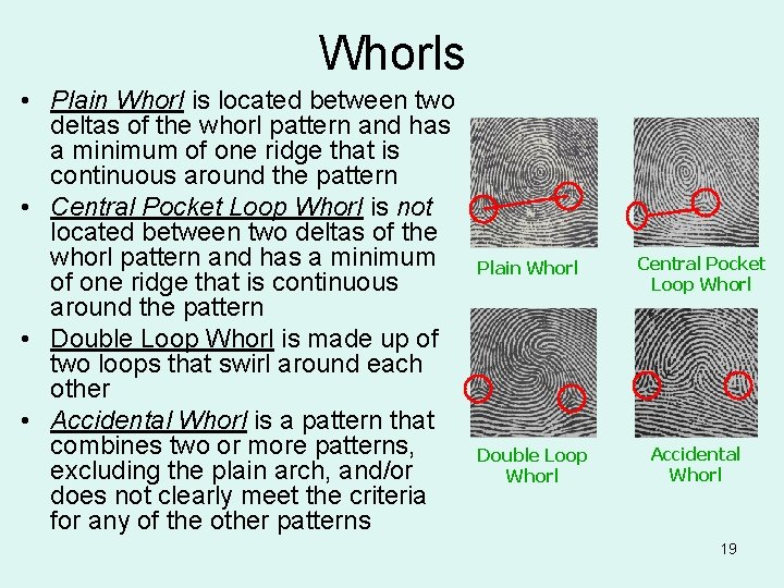 Whorls • Plain Whorl is located between two deltas of the whorl pattern and