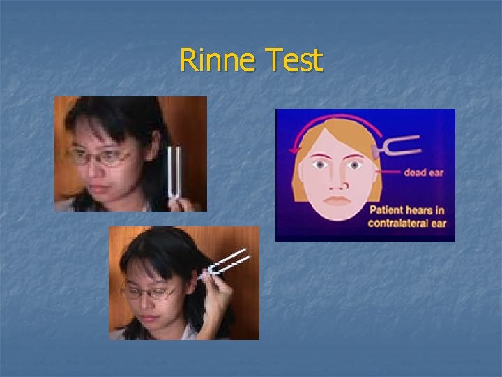 Rinne Test 