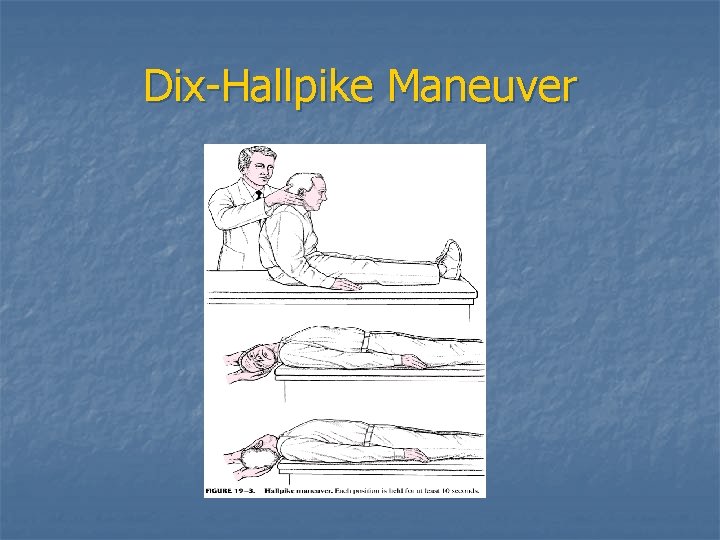 Dix-Hallpike Maneuver 