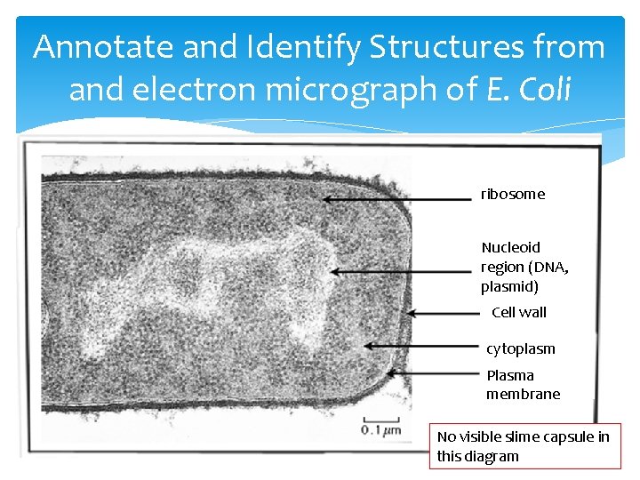 Annotate and Identify Structures from and electron micrograph of E. Coli ribosome Nucleoid region