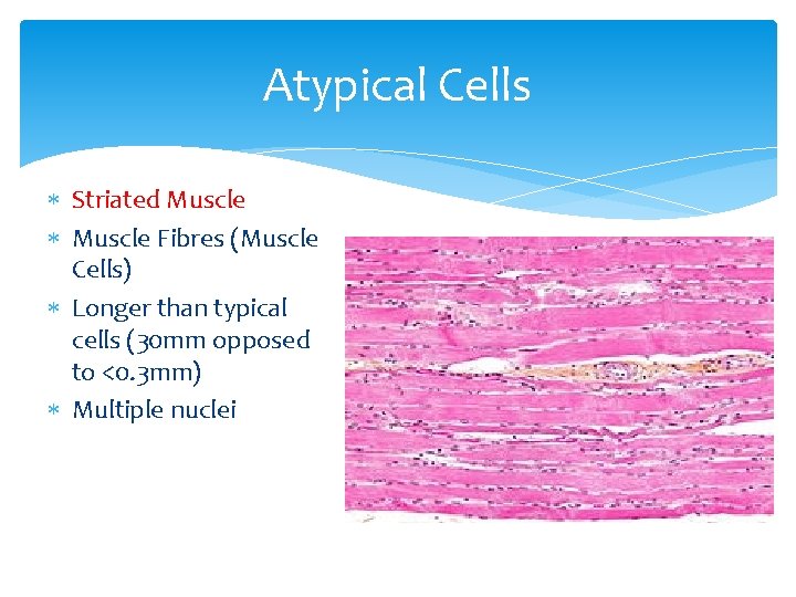 Atypical Cells Striated Muscle Fibres (Muscle Cells) Longer than typical cells (30 mm opposed