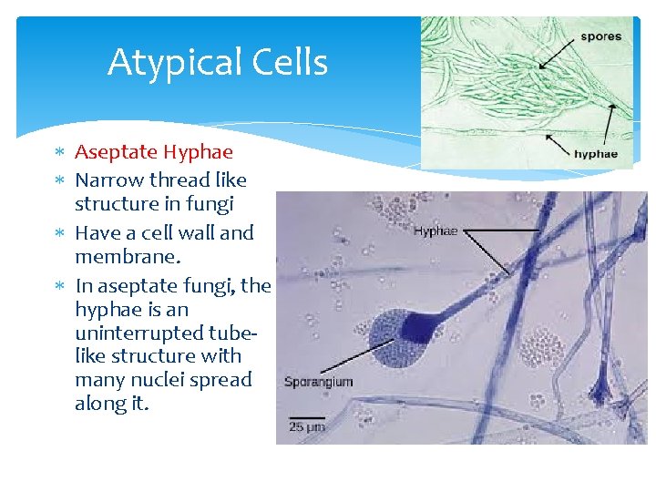 Atypical Cells Aseptate Hyphae Narrow thread like structure in fungi Have a cell wall