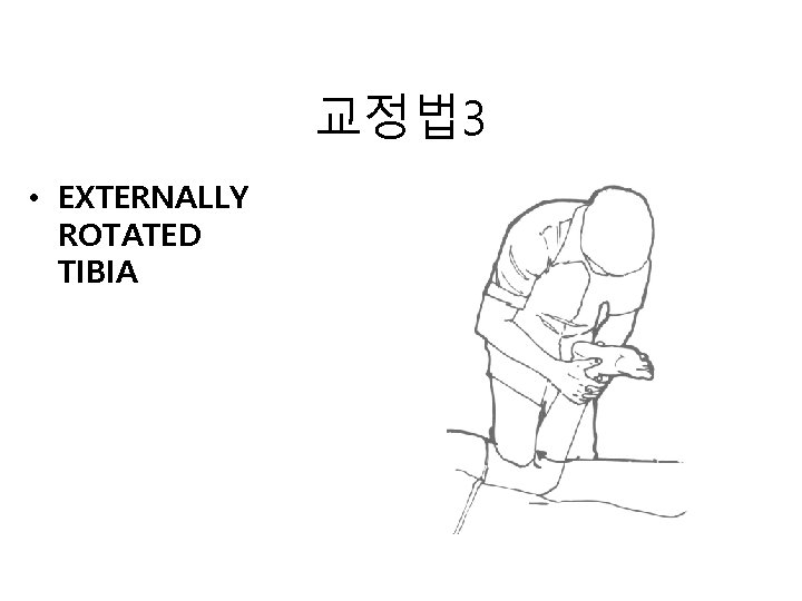 교정법 3 • EXTERNALLY ROTATED TIBIA 