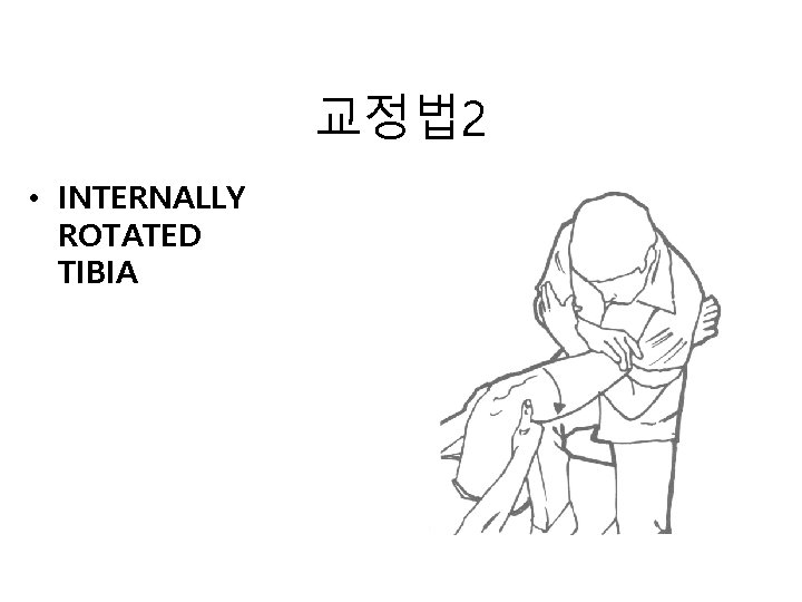 교정법 2 • INTERNALLY ROTATED TIBIA 