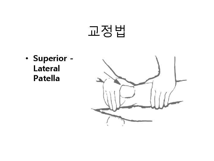 교정법 • Superior Lateral Patella 