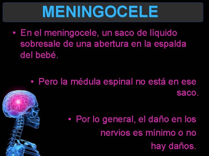 MENINGOCELE • En el meningocele, un saco de líquido sobresale de una abertura en