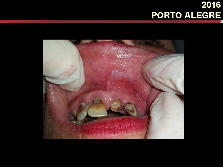 2016 PORTO ALEGRE 2016 PORTO ALEGRE