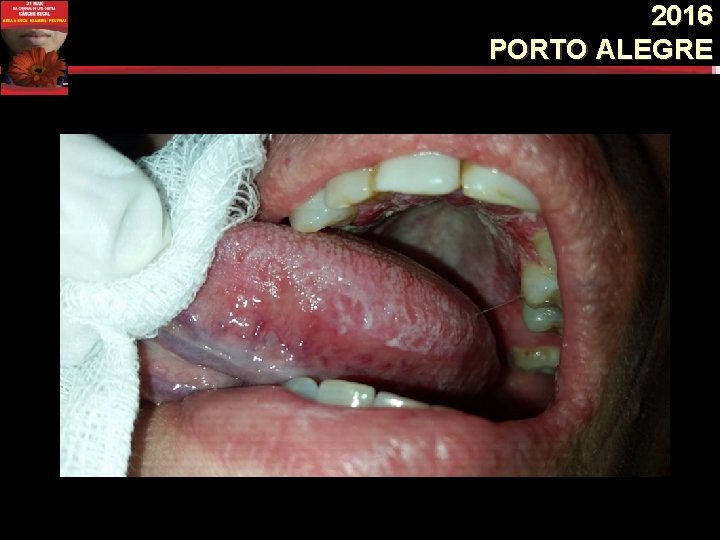 2016 PORTO ALEGRE 2016 PORTO ALEGRE