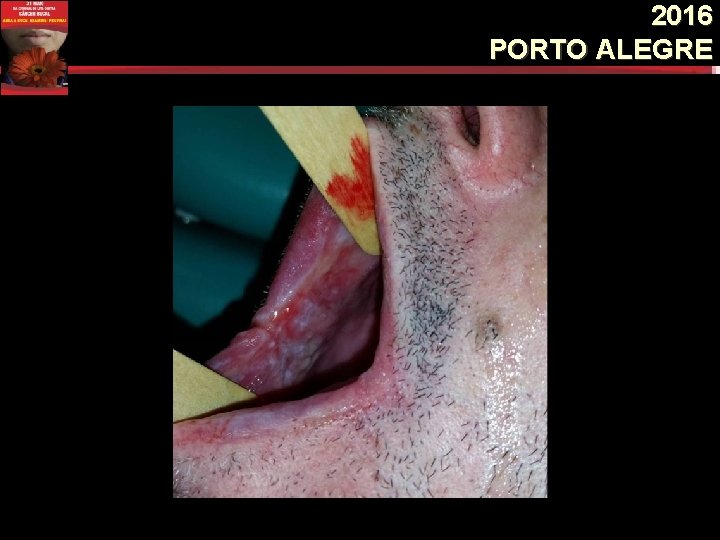2016 PORTO ALEGRE 2016 PORTO ALEGRE