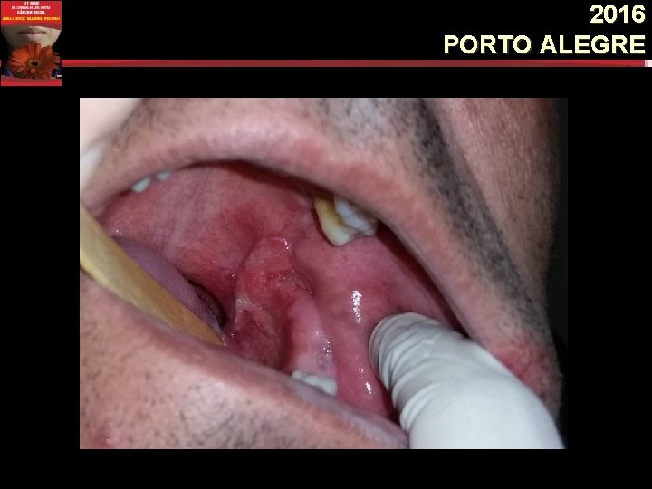 2016 PORTO ALEGRE 2016 PORTO ALEGRE