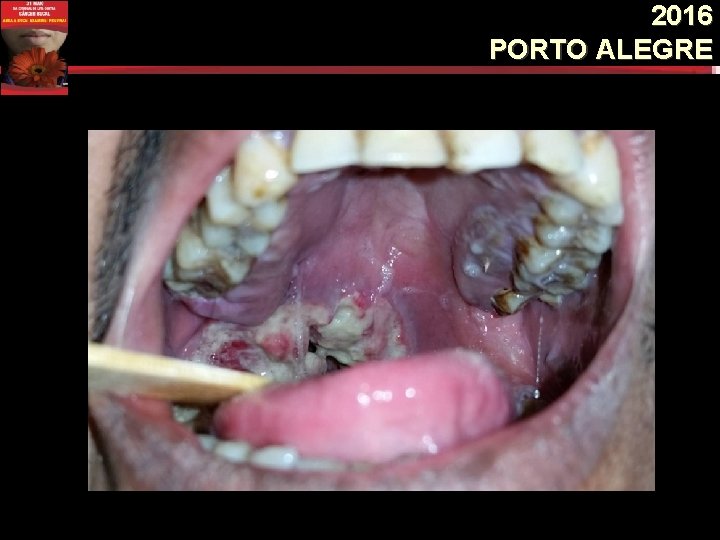 2016 PORTO ALEGRE 2016 PORTO ALEGRE