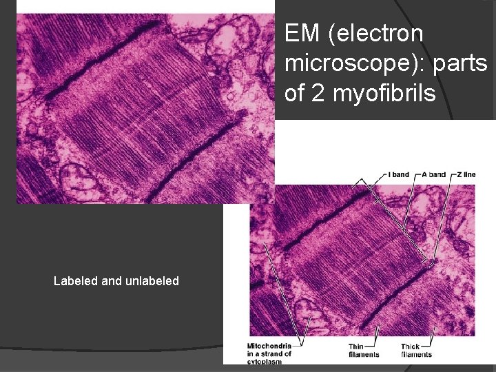 EM (electron microscope): parts of 2 myofibrils Labeled and unlabeled 