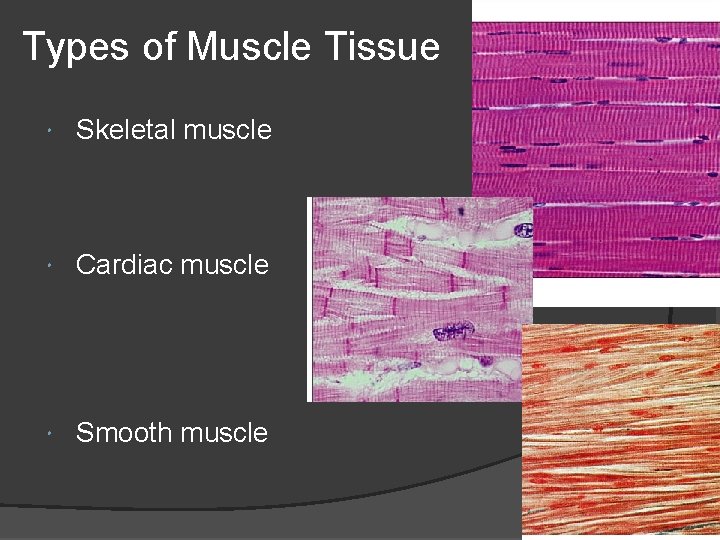 Types of Muscle Tissue Skeletal muscle Cardiac muscle Smooth muscle 