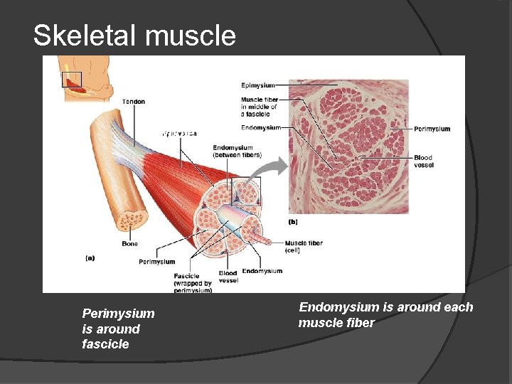 Skeletal muscle Epimysium: surrounds whole muscle Perimysium is around fascicle Endomysium is around each