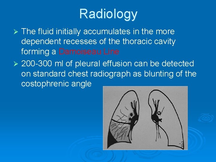 Radiology The fluid initially accumulates in the more dependent recesses of the thoracic cavity