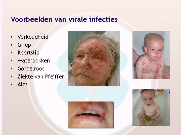 Voorbeelden van virale infecties • • Verkoudheid Griep Koortslip Waterpokken Gordelroos Ziekte van Pfeiffer