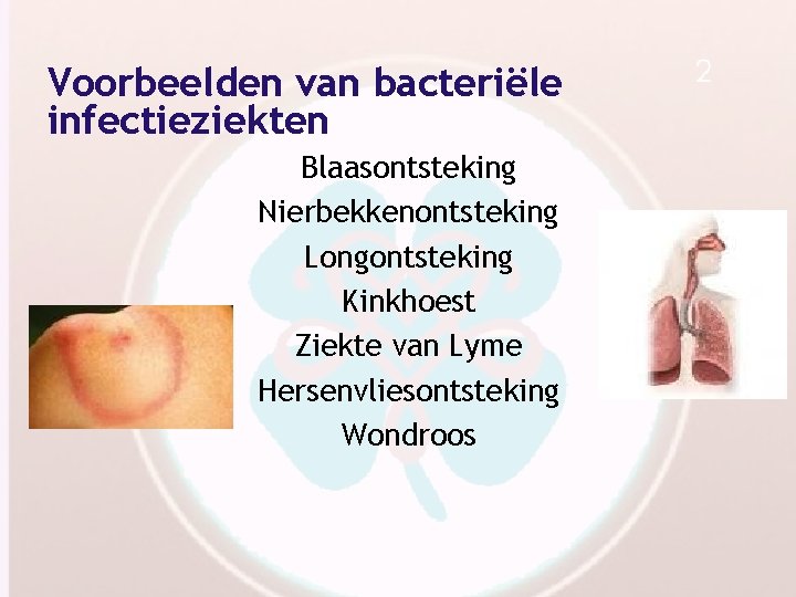 Voorbeelden van bacteriële infectieziekten Blaasontsteking Nierbekkenontsteking Longontsteking Kinkhoest Ziekte van Lyme Hersenvliesontsteking Wondroos 