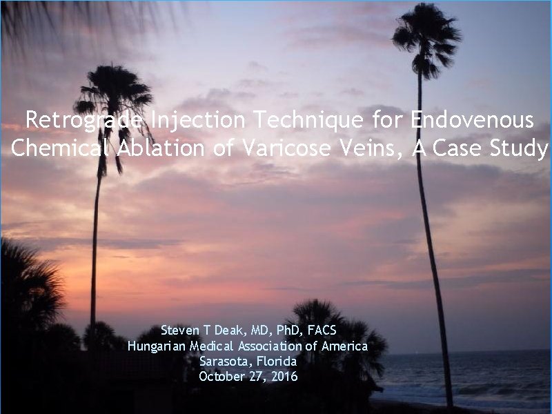 Retrograde Injection Technique for Endovenous Chemical Ablation of Varicose Veins, A Case Study Steven