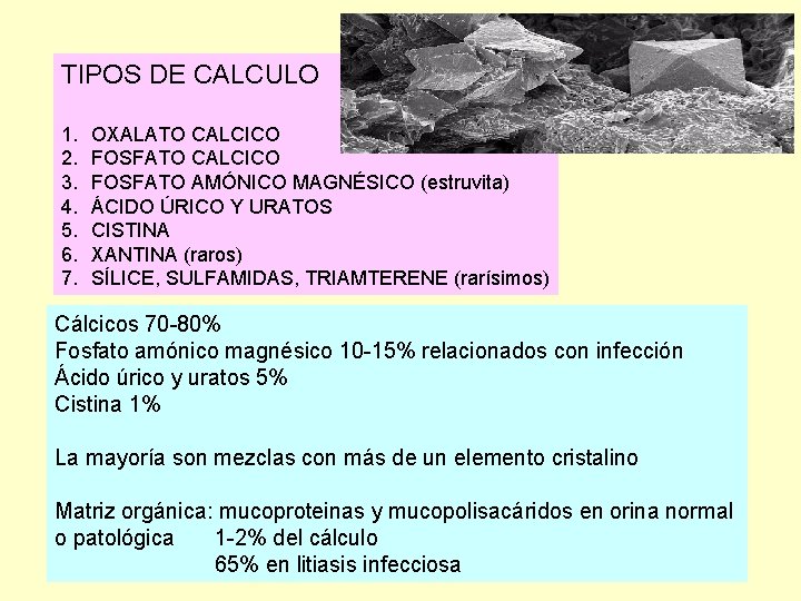 TIPOS DE CALCULO 1. 2. 3. 4. 5. 6. 7. OXALATO CALCICO FOSFATO AMÓNICO