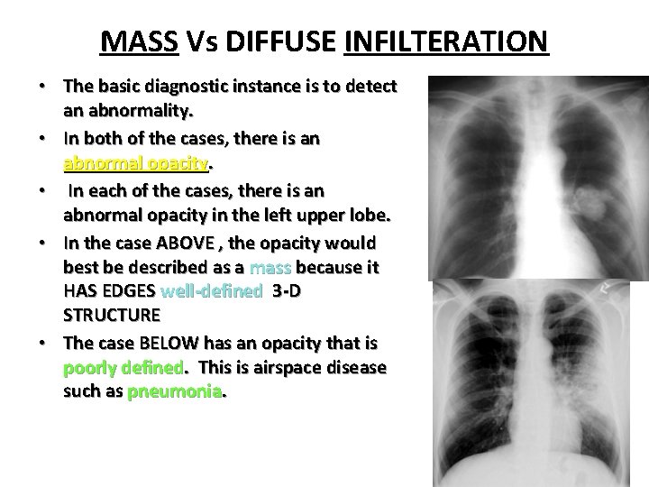 MASS Vs DIFFUSE INFILTERATION • The basic diagnostic instance is to detect an abnormality.