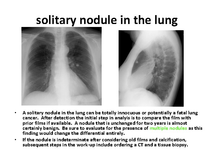 solitary nodule in the lung • • A solitary nodule in the lung can
