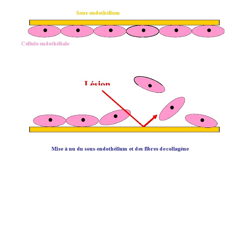 Sous-endothélium Cellule endothéliale Lésion Mise à nu du sous-endothélium et des fibres de collagène