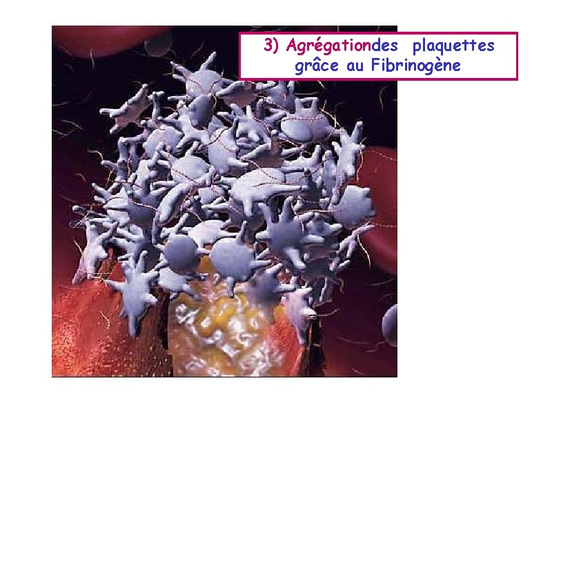 3) Agrégationdes plaquettes grâce au Fibrinogène 3) Agrégationdes plaquettes grâce au Fibrinogène