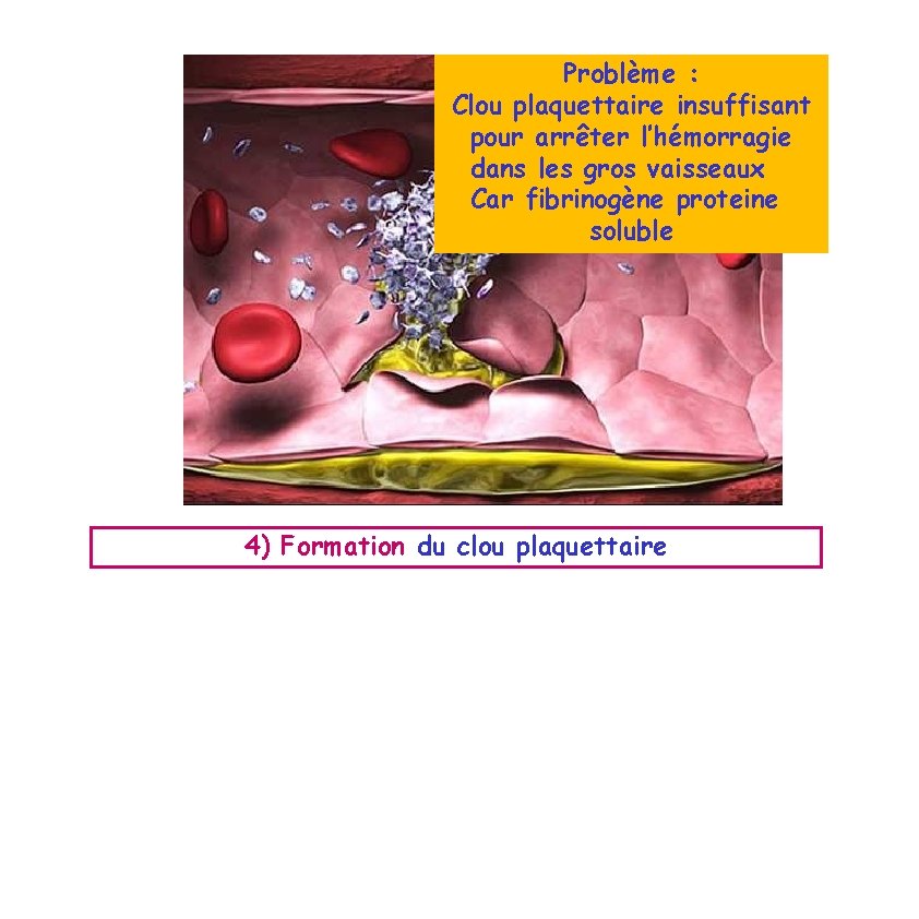 Problème : Clou plaquettaire insuffisant pour arrêter l’hémorragie dans les gros vaisseaux Car fibrinogène