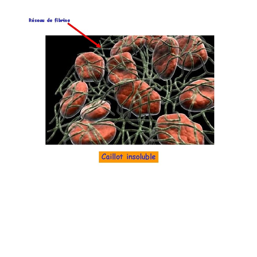 Réseau de fibrine Caillot insoluble 