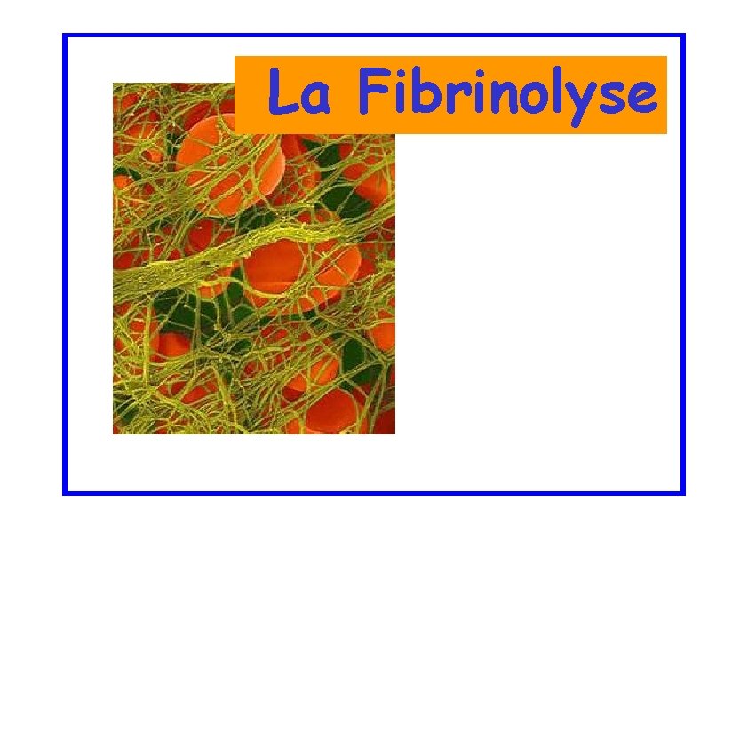 La Fibrinolyse 