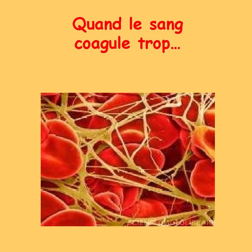 QQuauannddleleesang Quand ssaannggccooaatrop… ggululee coagule ttroropp…… 