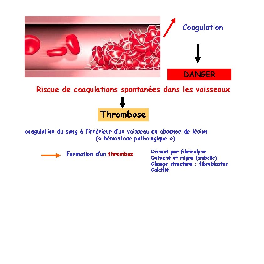 Coagulation DANGER Risque de coagulations spontanées dans les vaisseaux Thrombose coagulation du sang à