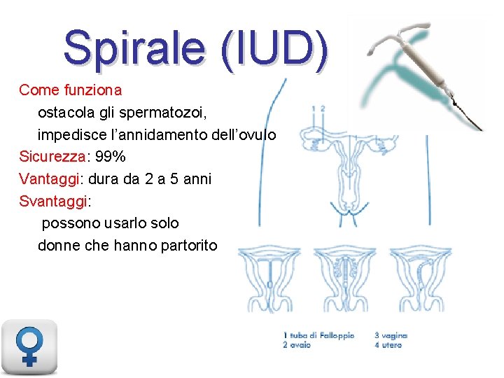 Spirale (IUD) Come funziona ostacola gli spermatozoi, impedisce l’annidamento dell’ovulo Sicurezza: 99% Vantaggi: dura