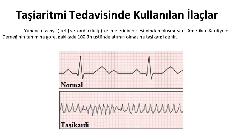 Taşiaritmi Tedavisinde Kullanılan İlaçlar Yunanca tachys (hızlı) ve kardia (kalp) kelimelerinin birleşiminden oluşmuştur. Amerikan