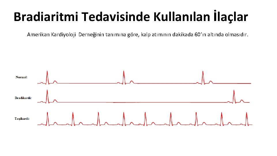 Bradiaritmi Tedavisinde Kullanılan İlaçlar Amerikan Kardiyoloji Derneğinin tanımına göre, kalp atımının dakikada 60’ın altında