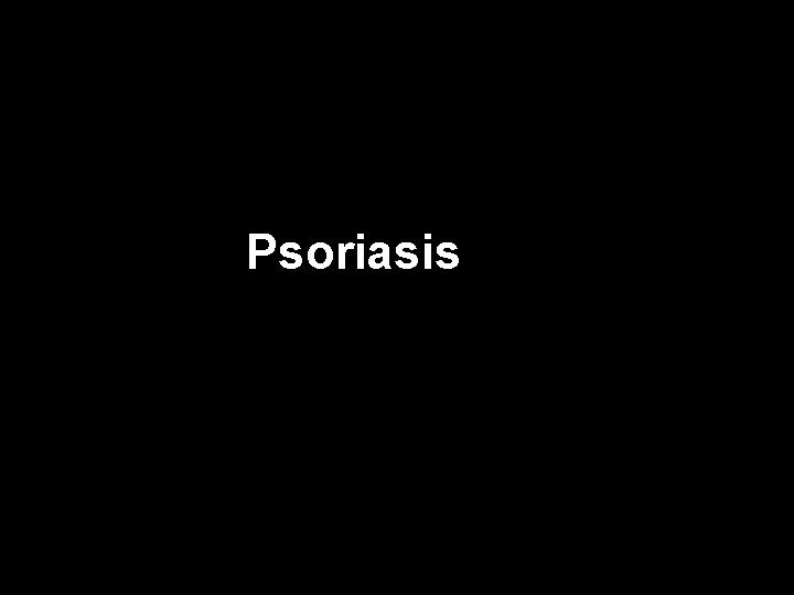 Psoriasis 