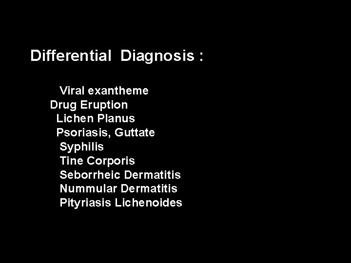 Differential Diagnosis : Viral exantheme Drug Eruption Lichen Planus Psoriasis, Guttate Syphilis Tine Corporis