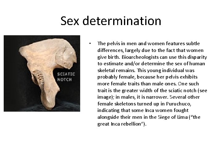 Sex determination • The pelvis in men and women features subtle differences, largely due