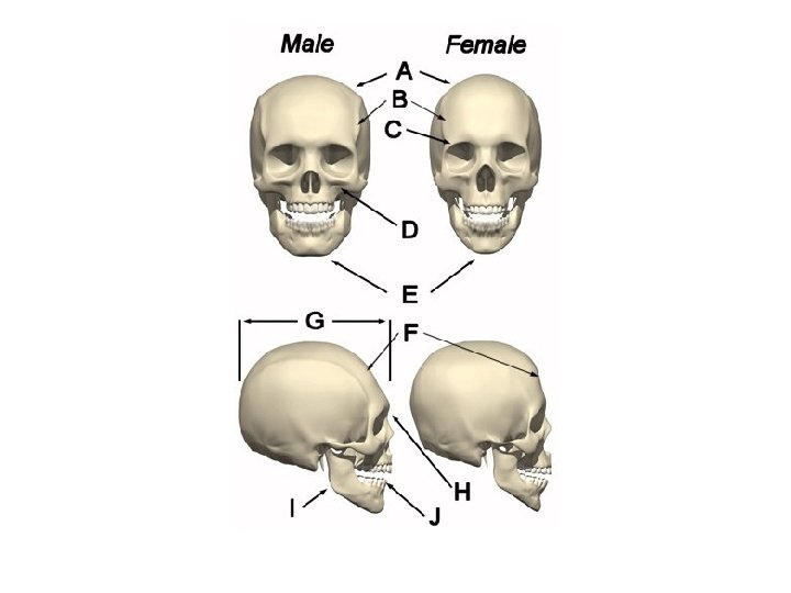 Determination of Sex 2. Cranium second best • Crests and ridges more pronounced in