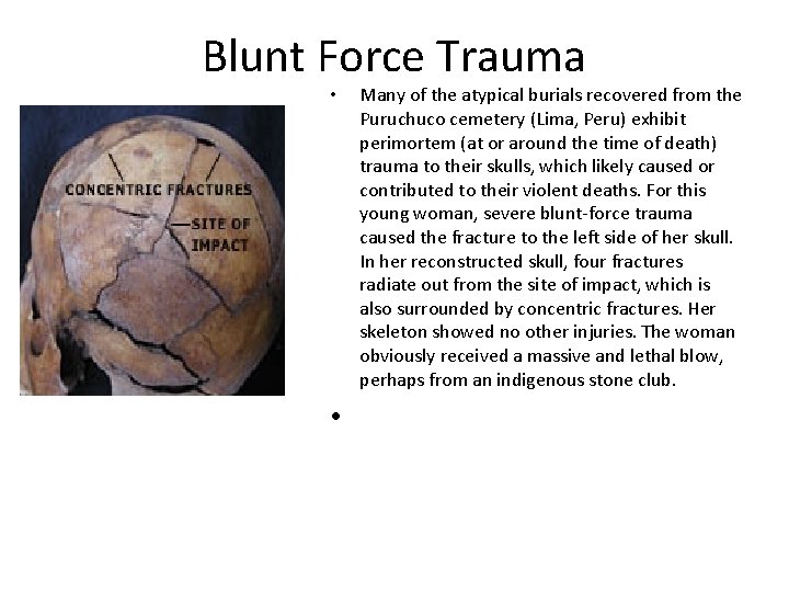 Blunt Force Trauma • • Many of the atypical burials recovered from the Puruchuco