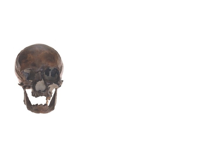 Facial Reconstruction 1. Obtain skull • Determine demographic information (female, Caucasian, early 40 s)