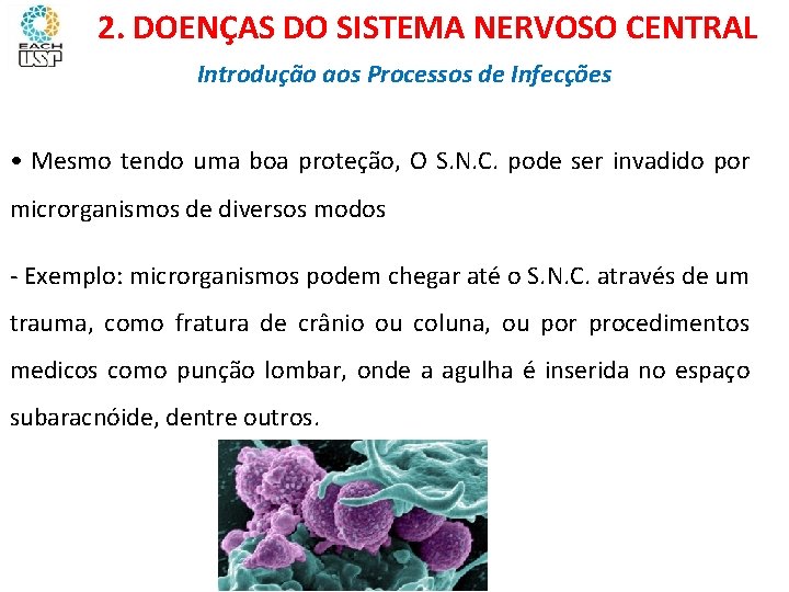 Ciências, 8º ano Sistema nervoso e as principais doenças 2. DOENÇAS DO SISTEMA NERVOSO