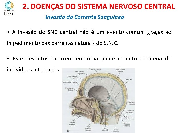 Ciências, 8º ano Sistema nervoso e as principais doenças 2. DOENÇAS DO SISTEMA NERVOSO